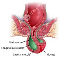 [胃胀]胃胀常见的八种伴随症状