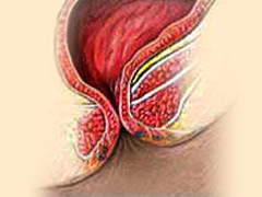 女性肠道水疗